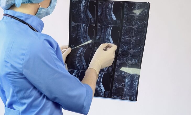 Die Diagnose „zervikale Osteochondrose wird auf der Grundlage einer MRT-Untersuchung gestellt