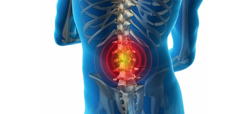 Methoden zur Diagnose von Rückenschmerzen
